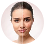 Skin Transformation